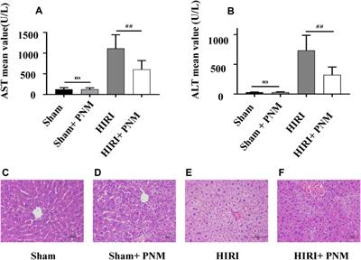 The Protective Effect of Panax notoginseng Mixture on Hepatic Ischemia/Reperfusion Injury in Mice via Regulating NR3C2, SRC, and GAPDH